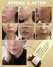 Bio Seacil Exfola Kit
